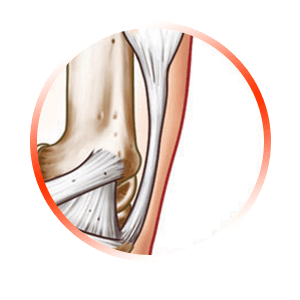 TENDON REGENERATION