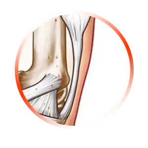 TENDON REGENERATION