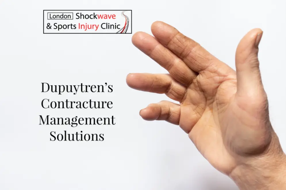 TREATMENT CHOICES FOR DUPUYTREN'S CONTRACTURE
